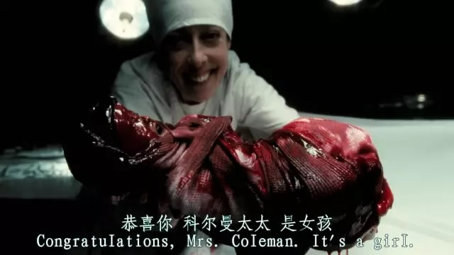 現實版孤兒怨VS電影版《孤兒怨》現實永遠比電影更恐怖,太嚇人了!