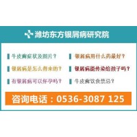 濰坊看銀屑病專業的公立醫院