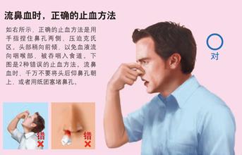 流鼻血怎么能快速止血,鼻出血的正確止血方法